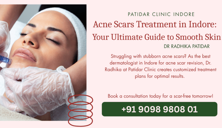 Acne Scars Treatment in Indore:  Your Ultimate Guide to Smooth Skin