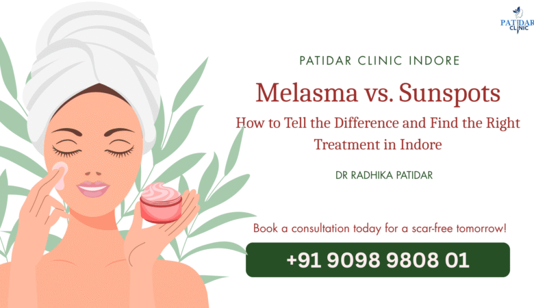 Melasma vs. Sunspots: How to Tell the Difference and Find the Right Treatment in Indore